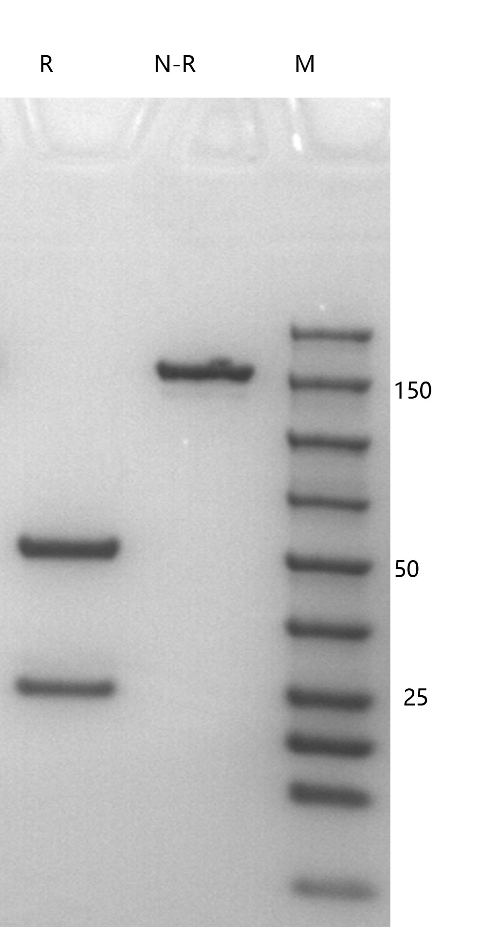 SDS-PAGE纯度验证电泳图